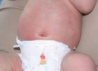 Belly button close up