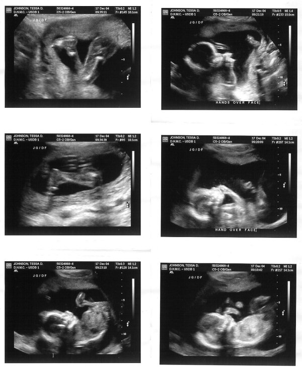 All 6 pictures of Baby J