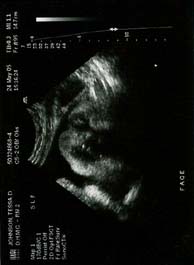 41 week ultrasound of baby's face